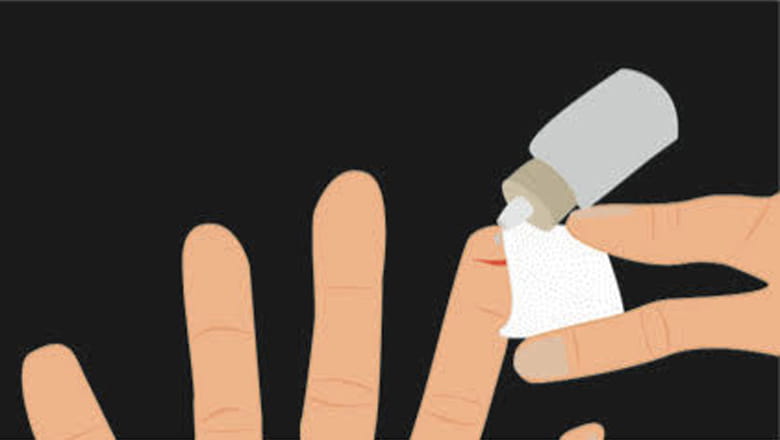 Tips voor pleisters plakken